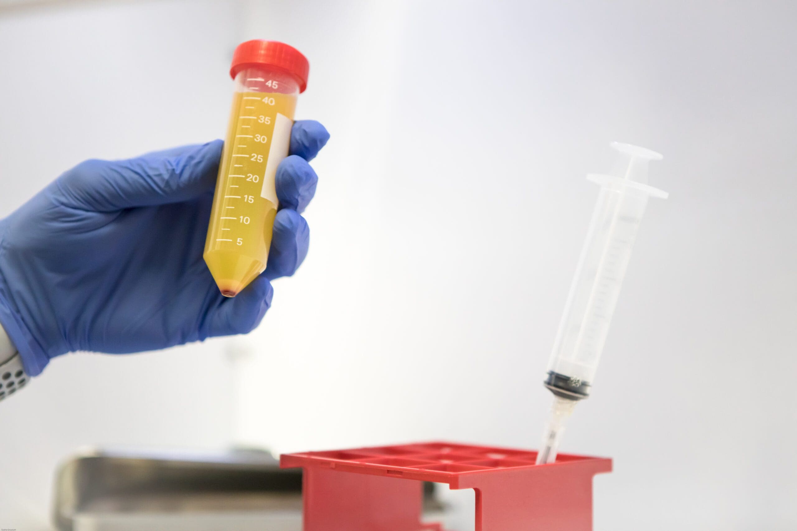 PRP solution PRP solution