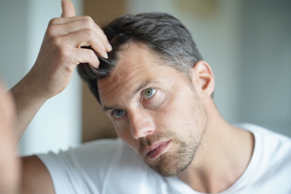 Hair loss treatment