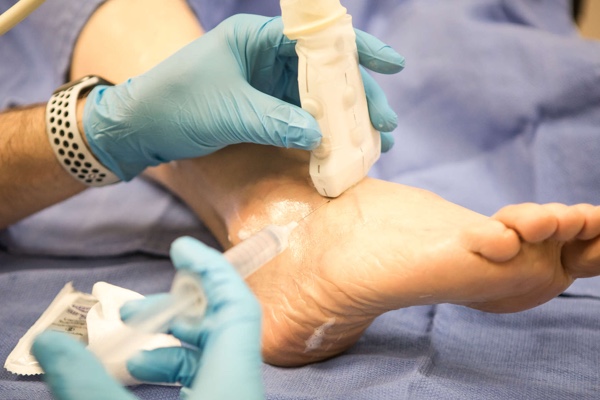 prolotherapy