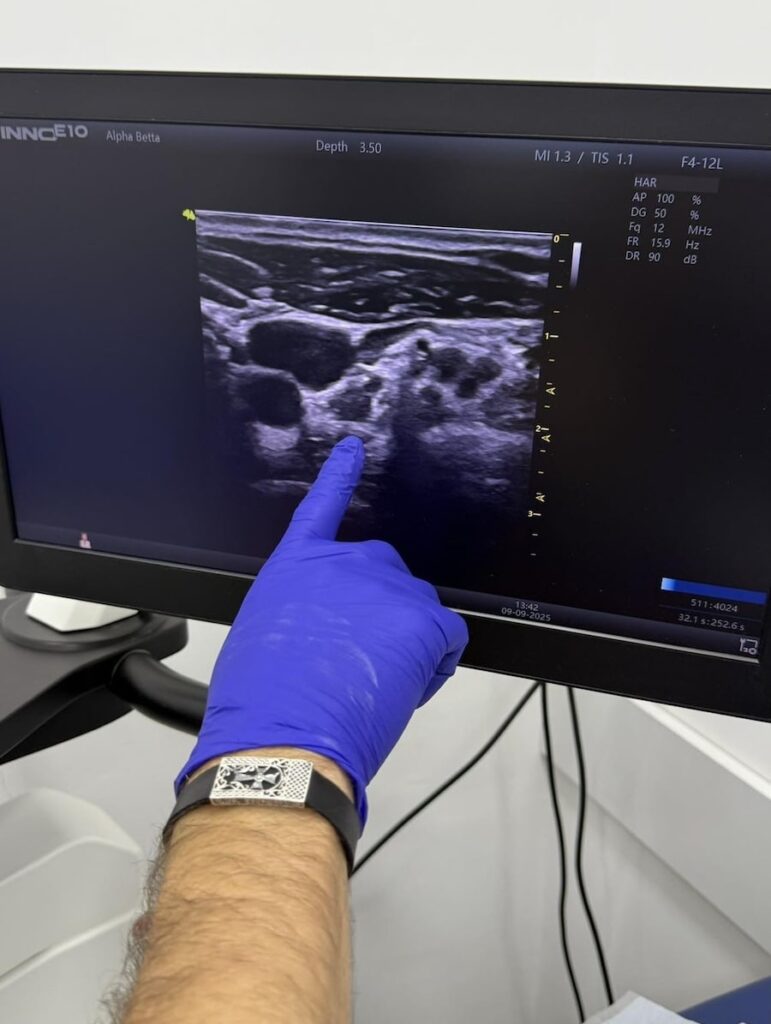 ultrasound