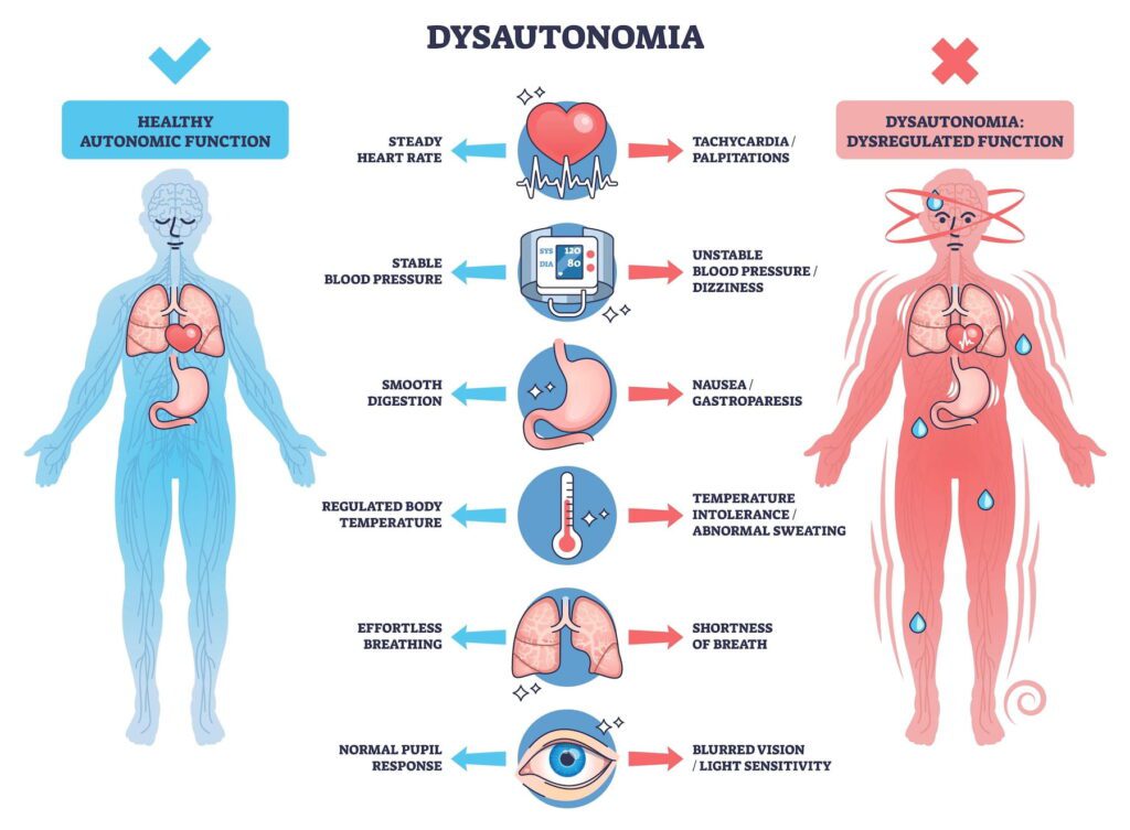 dysautonomia