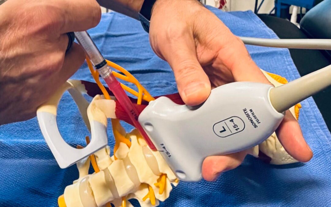 Single, Dual, DSR and Bilateral Stellate Ganglion Blocks: What’s the Difference?