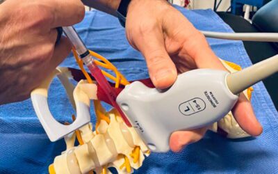 Single, Dual, DSR and Bilateral Stellate Ganglion Blocks: What’s the Difference?